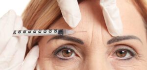 Botox treatment